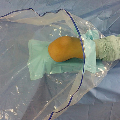 De medische Beschikbare Chirurgische Knie Arthroscopy drapeert Pak/Uitrusting