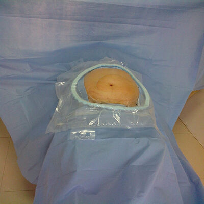 Eenmalige chirurgische verpakkingen met versterkte absorberende kritieke zones en EO-sterilisatie voor ziekenhuisnood